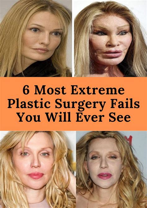 failure of plastic surgery